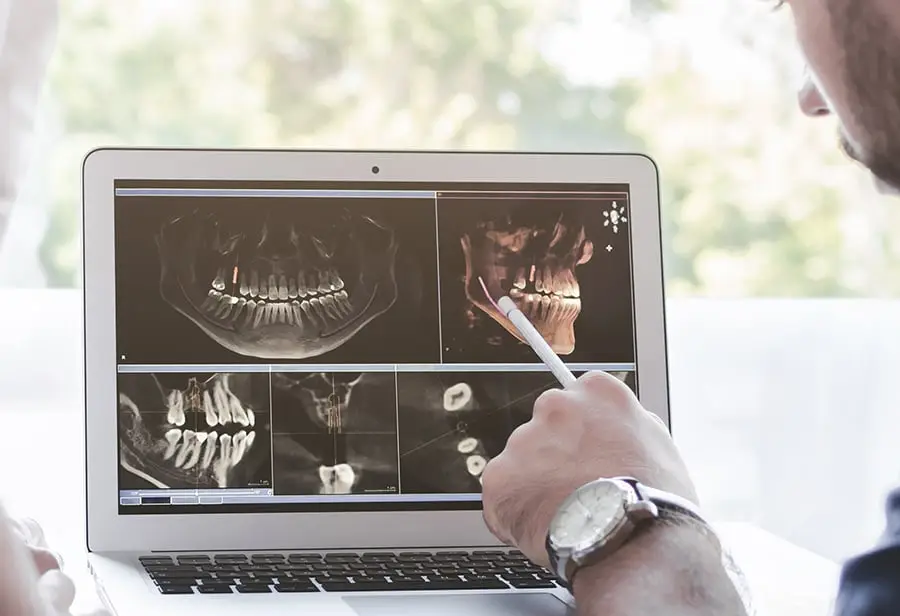 On-Site 3D CT Scanner
