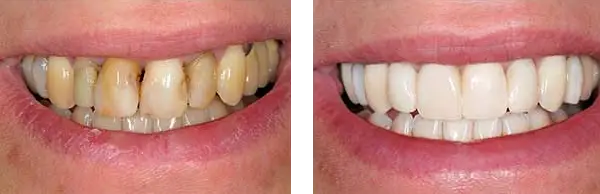 Real results from real patients